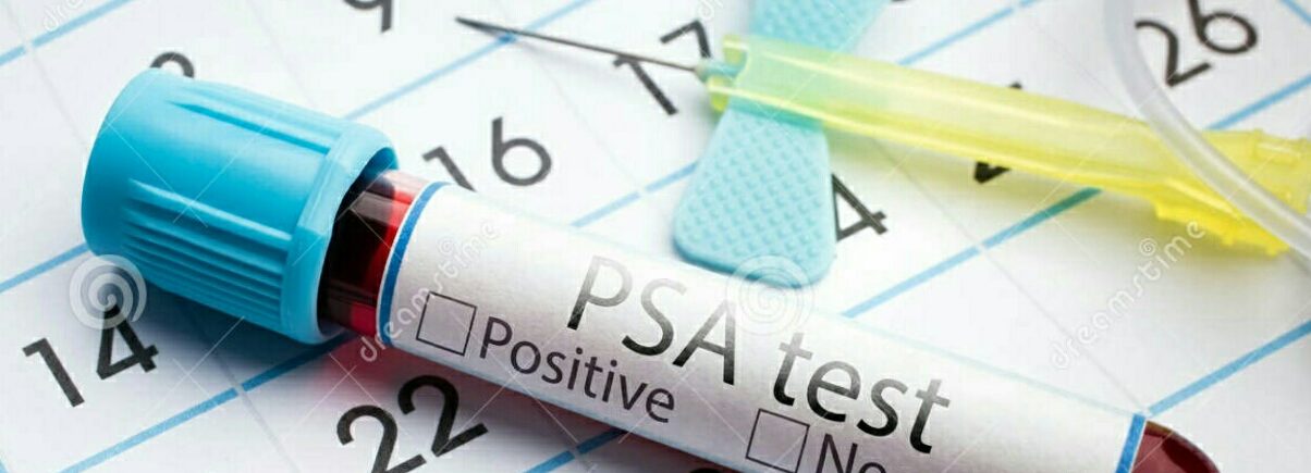 PSA nədir - prostat spesifik antigen